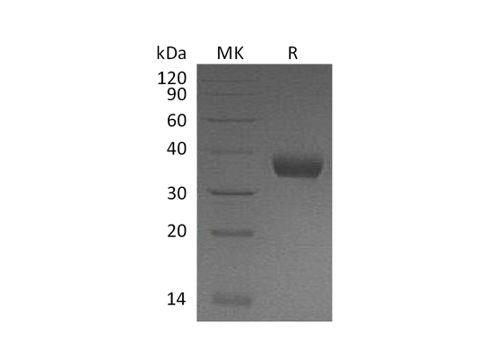 Recombinant Mouse PRLR (C-6His)