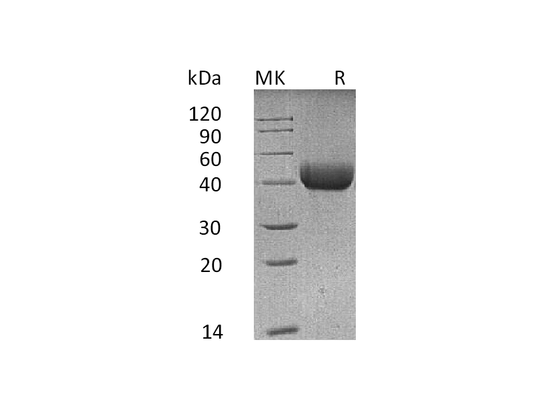 Recombinant Mouse SP-D (C-6His)