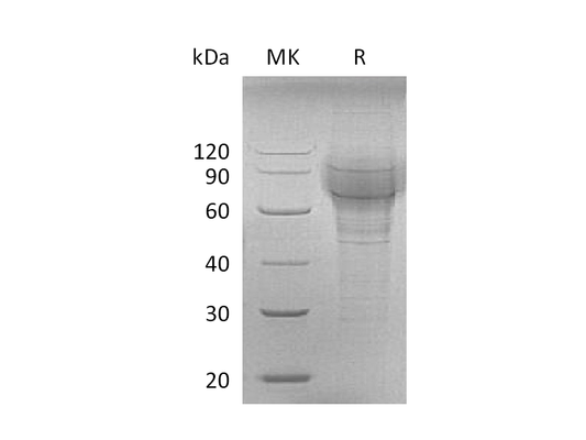 Recombinant Mouse TPO (C-6His)