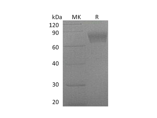 Recombinant Mouse Serpin F2 (C-6His)