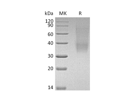 Recombinant Mouse SLAMF9 (C-6His)