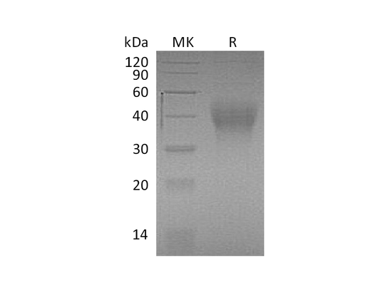 Recombinant Mouse TIM-3 (C-6His)