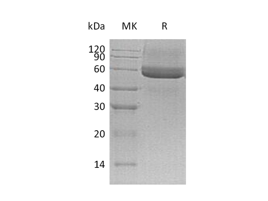 Recombinant Mouse Testican 3 (C-6His)