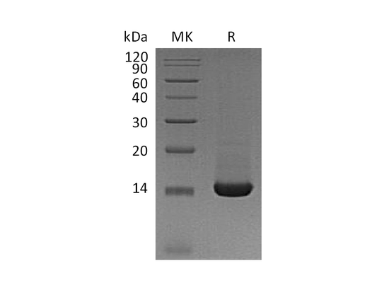Recombinant Mouse TFF2 (C-6His)