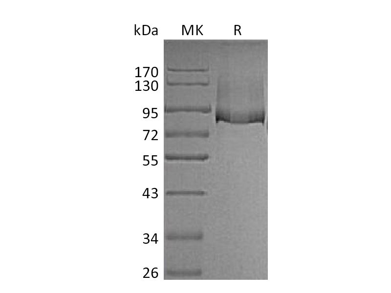 Recombinant Mouse Thrombomodulin (C-6His)