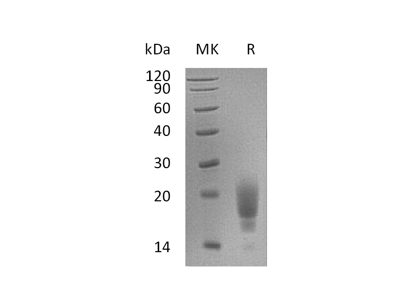 Recombinant Mouse TIGIT (C-6His)