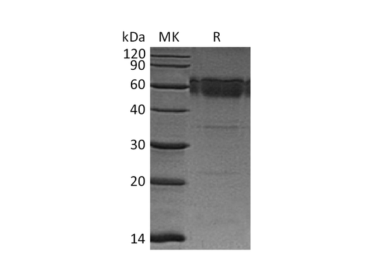Recombinant Mouse TRAIL R2 (C-Fc)