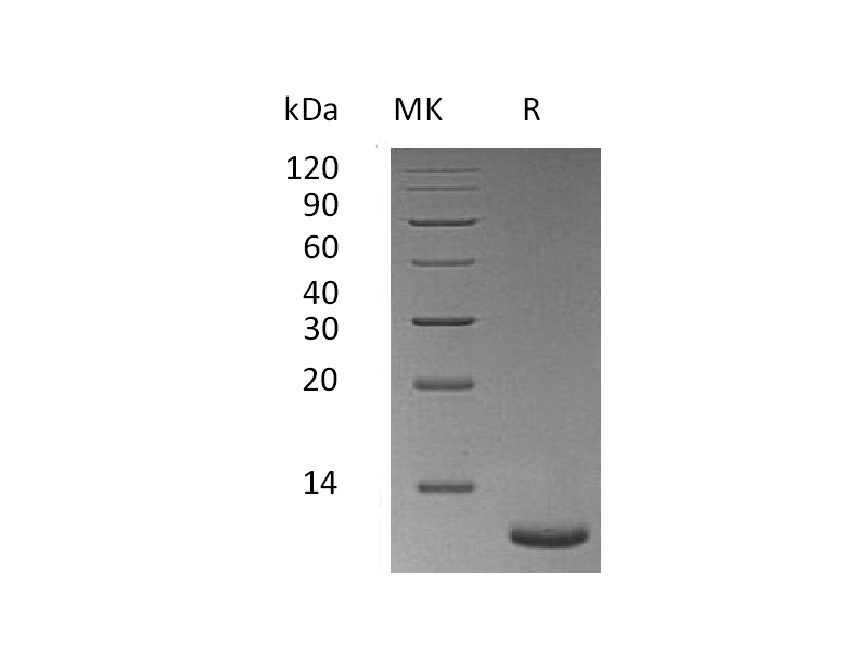 Recombinant Mouse TFF3 (C-6His)