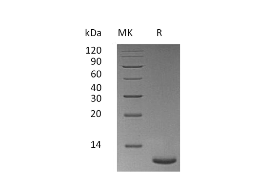 Recombinant Mouse TFF3 (C-6His)