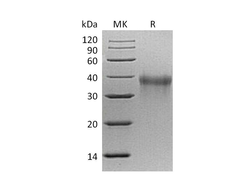 Recombinant Mouse TREM-1 (C-6His)