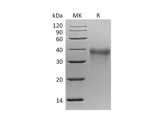Recombinant Mouse TREM-1 (C-6His)