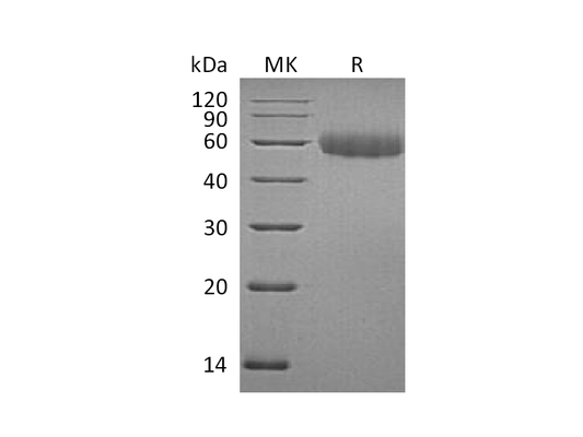 Recombinant Mouse TREML2 (C-6His)