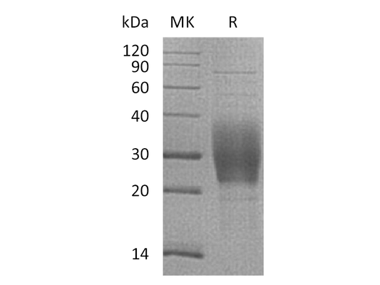 Recombinant Mouse TREM-2b (C-6His)