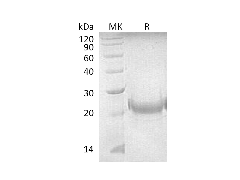 Recombinant Mouse OX40L (N-8His)