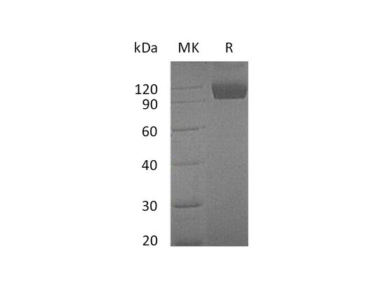 Recombinant Mouse Dtk (C-Fc)
