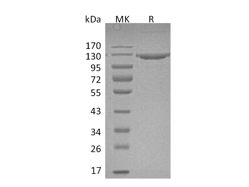Recombinant Mouse VCAM-1 (C-Fc)