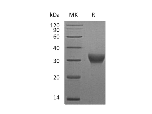 Recombinant Mouse VSIG4 (C-6His)