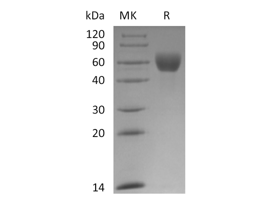 Recombinant Mouse Fetuin A (C-10His)