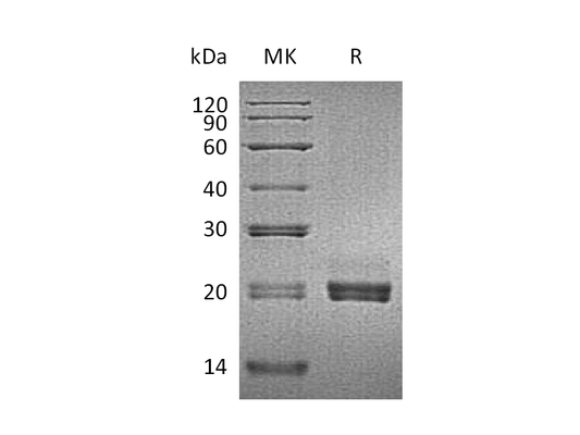 Recombinant Mouse CD40L (N-6His)