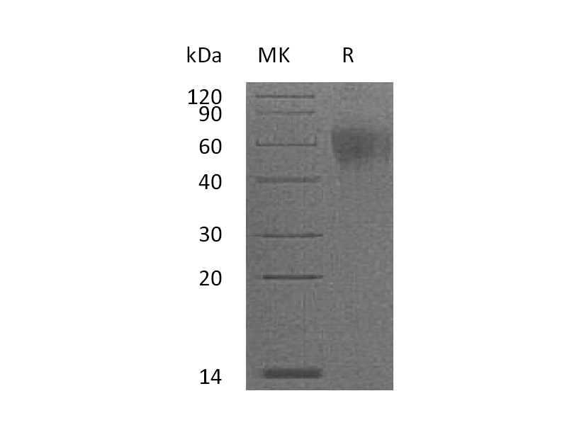 Recombinant Mouse IL-2RG (C-6His)