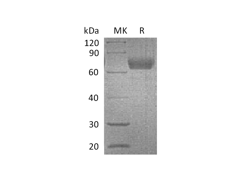 Recombinant Mouse IL-4RA (C-Fc)