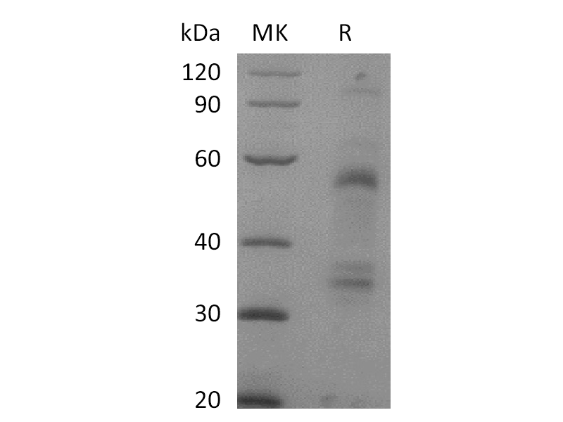 Recombinant Mouse HGF (C-6His)