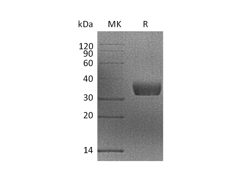 Recombinant Mouse Mgl2 (N-6His)