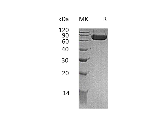 Recombinant Mouse Kirrel1 (C-6His)
