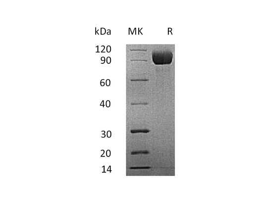 Recombinant Mouse IL-13RA1 (C-Fc)