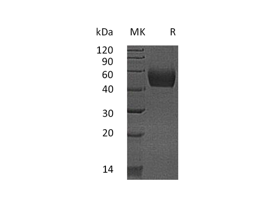 Recombinant Mouse Lumican (C-6His)