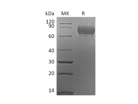 Recombinant Mouse CADM1 (C-6His)