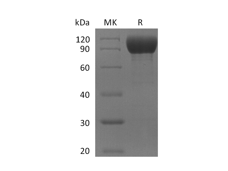 Recombinant Mouse IL-1RL2 (C-Fc)