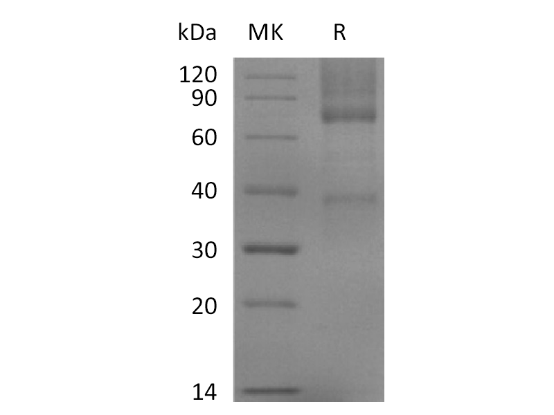Recombinant Mouse GPC3 (C-6His)