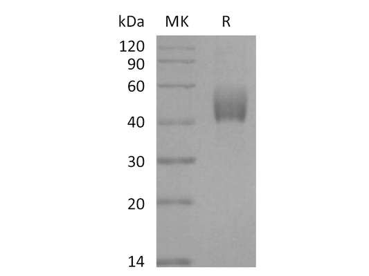 Recombinant Mouse TGFBR1 (C-Fc)