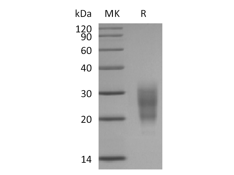 Recombinant Mouse NKG2D (N-6His)