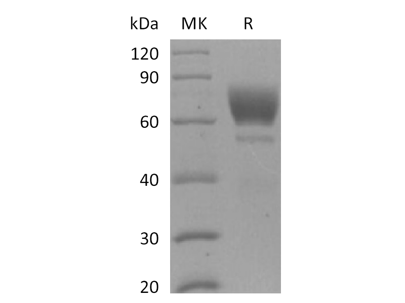 Recombinant Mouse AXL (C-6His)