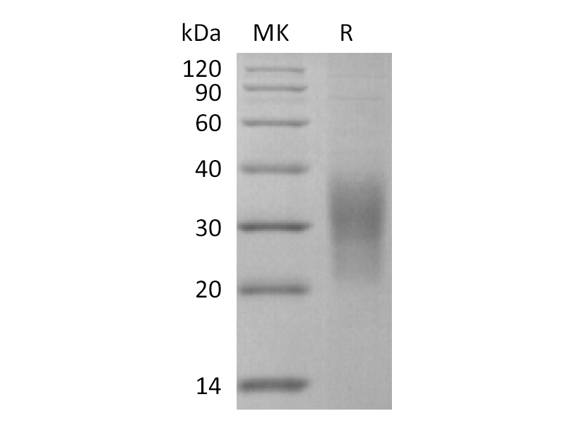 Recombinant Mouse SECTM1A (C-6His)