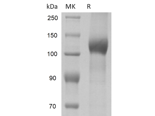 Recombinant Mouse LEPR (C-10His)
