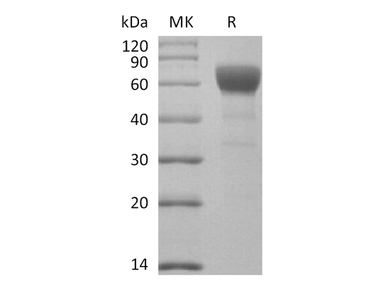 Recombinant Mouse TGFBR2 (C-Fc)
