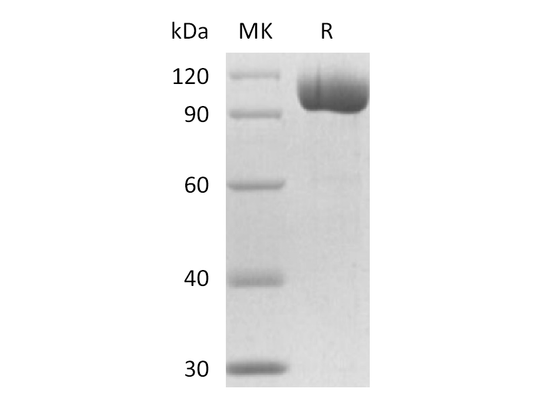 Recombinant Mouse PSMA (N-6His)