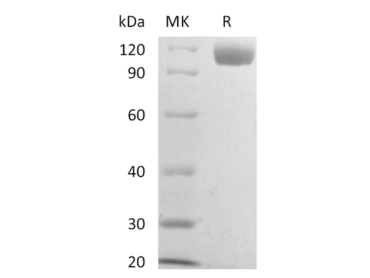 Recombinant Mouse Siglec-2 (C-6His)