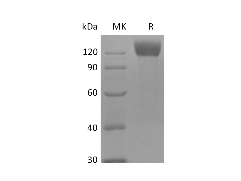 Recombinant Mouse APN Protein (C-6His)