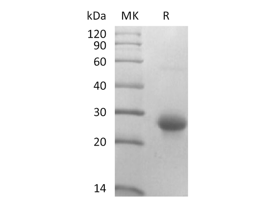 Recombinant Mouse CD27L (N-10His)