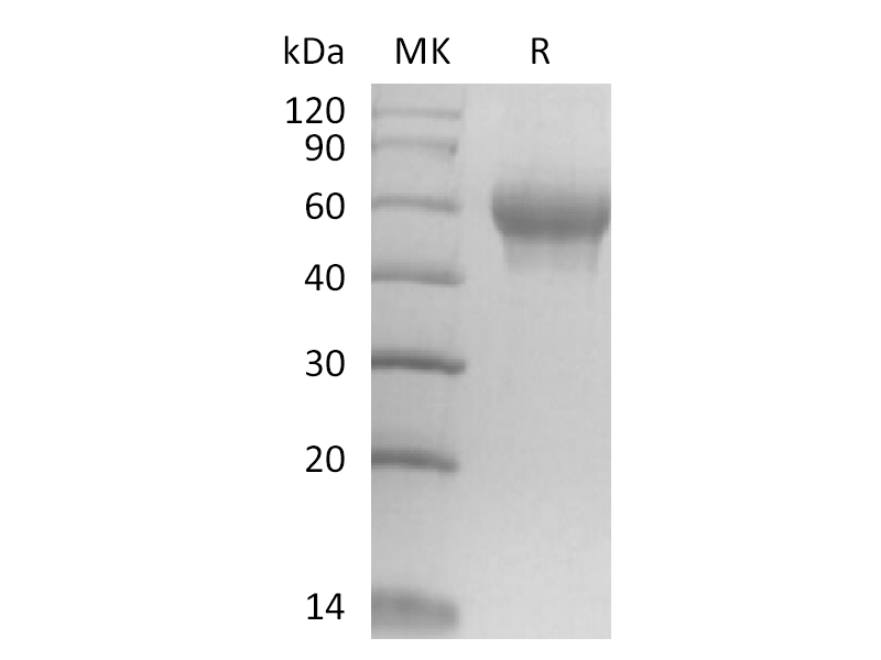 Recombinant Mouse IL-6RA (C-6His)