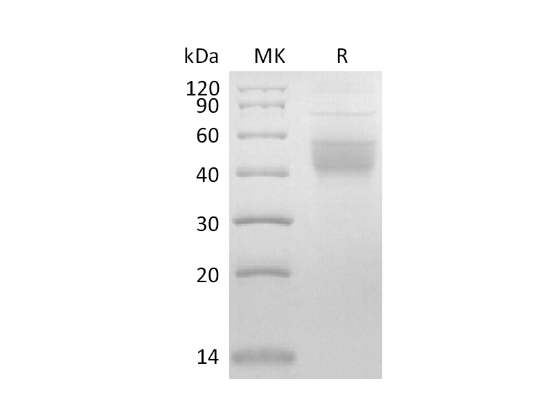 Recombinant Mouse IL-2RB (C-6His)