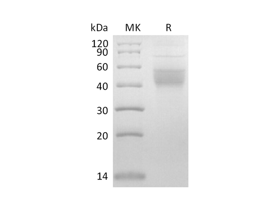 Recombinant Mouse IL-2RB (C-6His)