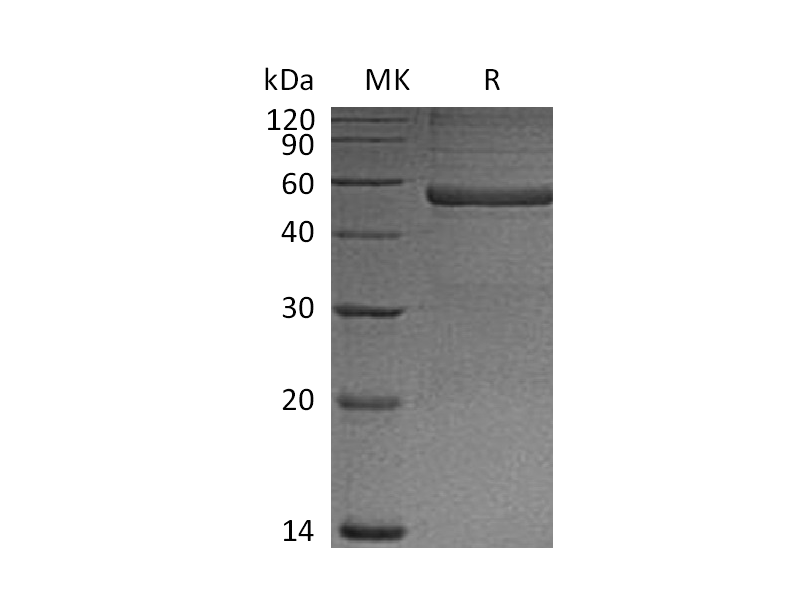 Recombinant Mouse PTX3 (N-6His)