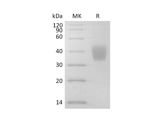 Recombinant Mouse IL-4RA (C-6His)
