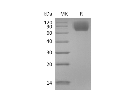 Recombinant Mouse TrkC (C-6His)