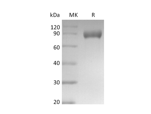 Recombinant Mouse Siglec-E (C-Fc)